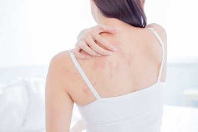 There is a greater diversity of fungal community in subjects with sensitive skin , compared to subjects with non-sensitive skin, according to a recent study. ©Getty Images